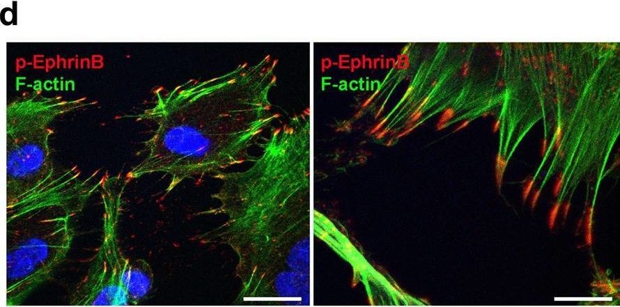 Fig.5.D showing Immunocytochemistry-immunofluorescence in a Homo sapiens (Human) sample from the publication: EphrinB2 controls vessel pruning through STAT1-JNK3 signalling.