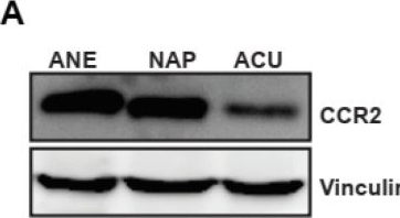 Fig.3.A showing Western Blotting in a Rattus norvegicus (Rat) sample from the publication: Electroacupuncture Alleviates Neuropathic Pain by Inhibiting Spinal CCL2-Driven Microglial Activation.