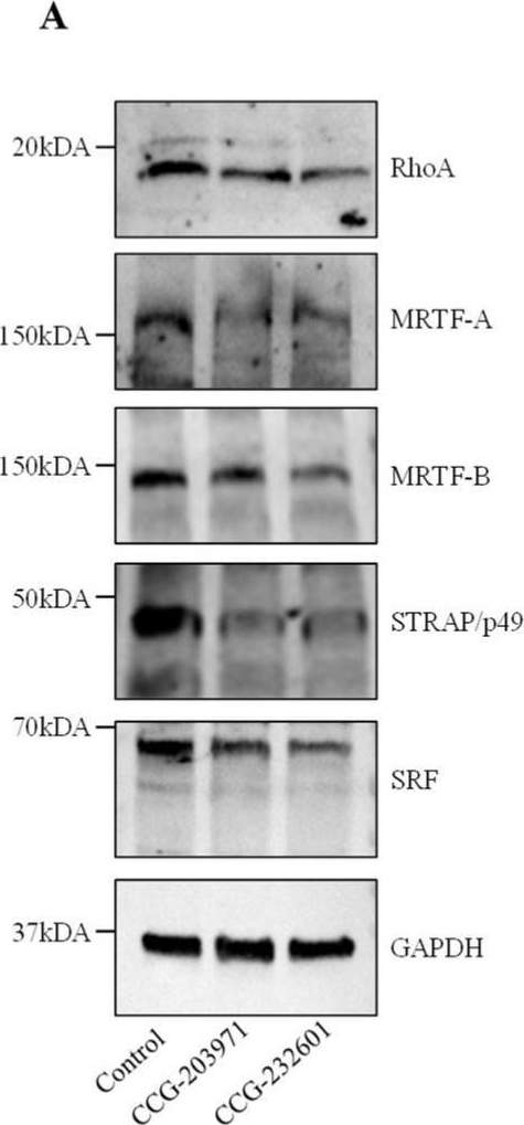 Fig.2.A showing Western Blotting in a Homo sapiens (Human) sample from the publication: Inhibitors of Rho/MRTF/SRF Transcription Pathway Regulate Mitochondrial Function.