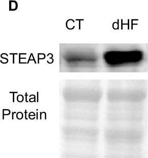 Fig.3.D showing Western Blotting in a Homo sapiens (Human) sample from the publication: Regulation of cardiac ferroptosis in diabetic human heart failure: uncovering molecular pathways and key targets.
