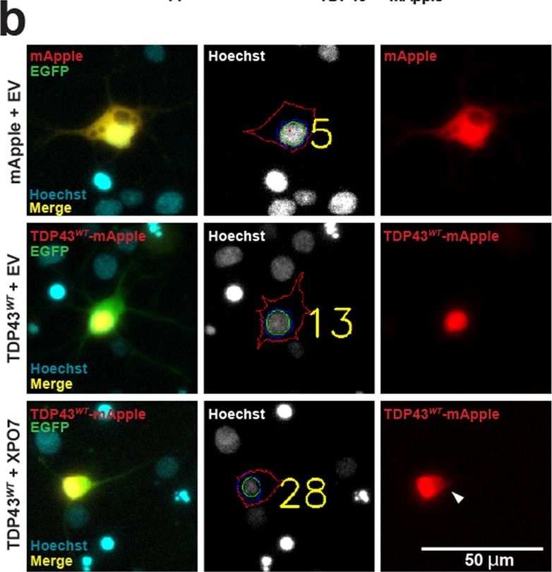 Fig.8.B showing Immunocytochemistry-immunofluorescence in a Rattus norvegicus (Rat) sample from the publication: TDP43 nuclear export and neurodegeneration in models of amyotrophic lateral sclerosis and frontotemporal dementia.