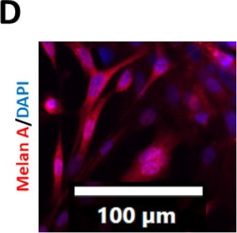 Fig.1.D showing Immunocytochemistry-immunofluorescence in a Homo sapiens (Human) sample from the publication: Vitamin D Modulates the Response of Patient-Derived Metastatic Melanoma Cells to Anticancer Drugs.