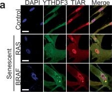 Fig.5.A showing Immunocytochemistry-immunofluorescence from the publication: METTL3-mediated chromatin contacts promote stress granule phase separation through metabolic reprogramming during senescence.