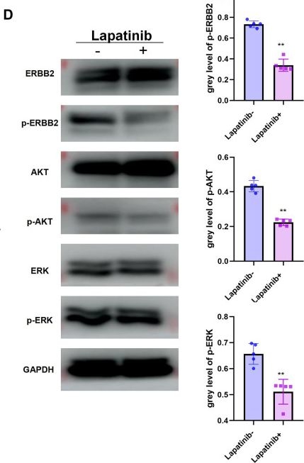 Fig.3.D showing Western Blotting from the publication: Stimulator of interferon response cGAMP interactor overcomes ERBB2-mediated apatinib resistance in head and neck squamous cell carcinoma.