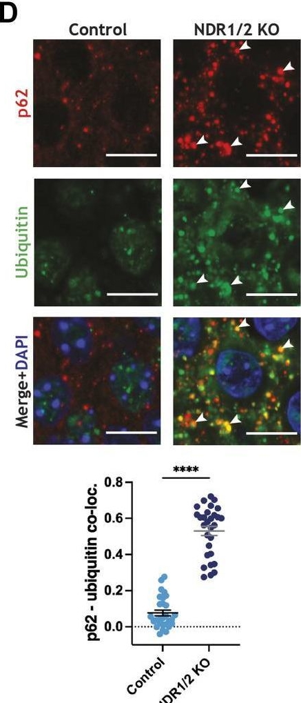 Loss of NDR1/2 kinases impairs endomembrane trafficking and autophagy leading to neurodegeneration.