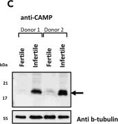 Fig.1.C showing Western Blotting in a Homo sapiens (Human) sample from the publication: The role of HnrnpF/H as a driver of oligoteratozoospermia.