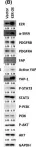 Fig.5.B showing Western Blotting from the publication: Pancreatic cancer-derived small extracellular vesical ezrin activates fibroblasts to exacerbate cancer metastasis through STAT3 and YAP-1 signaling pathways.