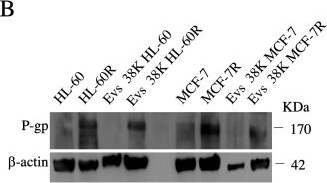Fig.1.B showing Western Blotting in a Homo sapiens (Human) sample from the publication: Vesicle-Transported Multidrug Resistance as a Possible Therapeutic Target of Natural Compounds.