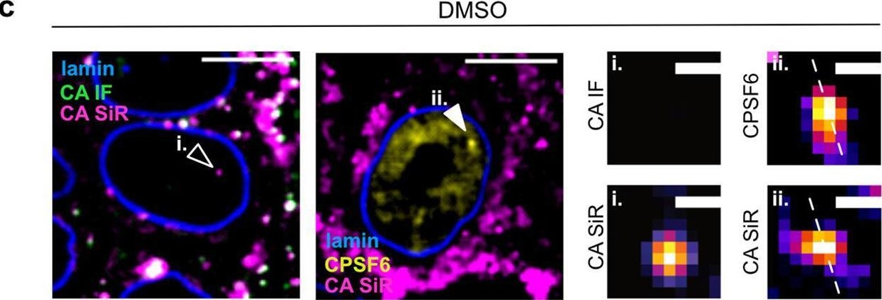 Fig.6.C showing Immunohistochemistry-immunofluorescence in a Homo sapiens (Human) sample from the publication: Direct Capsid Labeling of Infectious HIV-1 by Genetic Code Expansion Allows Detection of Largely Complete Nuclear Capsids and Suggests Nuclear Entry of HIV-1 Complexes via Common Routes.