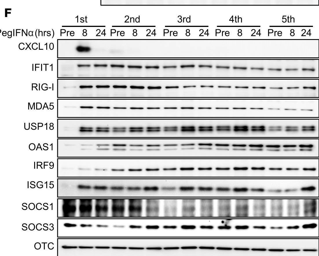 Fig.4.F showing Western Blotting in a Homo sapiens (Human) sample from the publication: Persistent hepatic IFN system activation in HBV-HDV infection determines viral replication dynamics and therapeutic response.