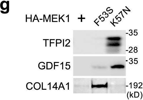 Fig.5.G showing Western Blotting in a Homo sapiens (Human) sample from the publication: Qualitative differences in disease-associated MEK mutants reveal molecular signatures and aberrant signaling-crosstalk in cancer.