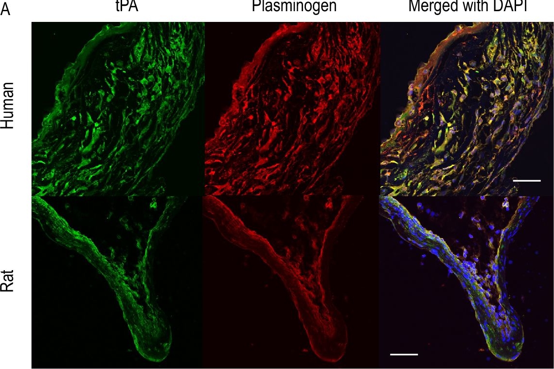 Fig.6.A showing Immunohistochemistry-immunofluorescence in a Mus musculus (House mouse) sample from the publication: C5a-C5AR1 axis as a potential trigger of the rupture of intracranial aneurysms.