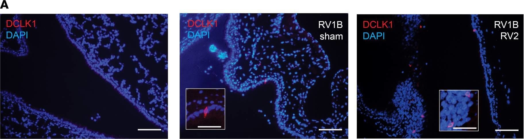 Fig.1.A showing Immunohistochemistry-immunofluorescence from the publication: Tuft cells are required for a rhinovirus-induced asthma phenotype in immature mice.