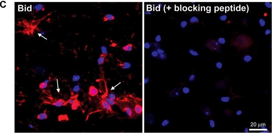 Fig.2.C showing Immunohistochemistry in a Mus musculus (House mouse) sample from the publication: The Bcl-2 Homology-3 Domain (BH3)-Only Proteins, Bid, DP5/Hrk, and BNip3L, Are Upregulated in Reactive Astrocytes of End-Stage Mutant SOD1 Mouse Spinal Cord.