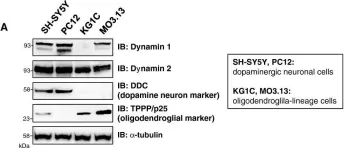 Fig.4.A showing Western Blotting from the publication: Suppression of dynamin GTPase decreases α-synuclein uptake by neuronal and oligodendroglial cells: a potent therapeutic target for synucleinopathy.
