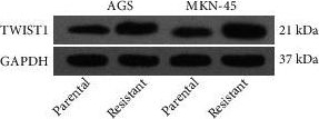 Fig.2.E showing Western Blotting in a Homo sapiens (Human) sample from the publication: TWIST1-EP300 Expedites Gastric Cancer Cell Resistance to Apatinib by Activating the Expression of COL1A2.
