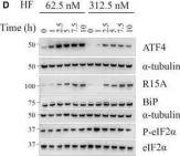 Fig.1.D showing Western Blotting from the publication: Cellular responses to halofuginone reveal a vulnerability of the GCN2 branch of the integrated stress response.