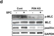 Fig.6.D showing Western Blotting from the publication: Paxillin participates in the sphingosylphosphorylcholine-induced abnormal contraction of vascular smooth muscle by regulating Rho-kinase activation.