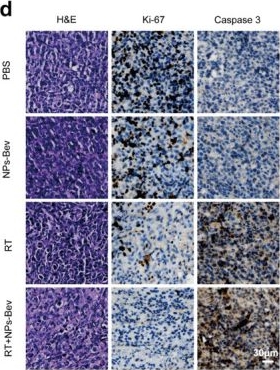 Fig.8.D showing Immunohistochemistry in a Homo sapiens (Human) sample from the publication: Novel Self-Assembled Multifunctional Nanoprobes for Second-Near-Infrared-Fluorescence-Image-Guided Breast Cancer Surgery and Enhanced Radiotherapy Efficacy.