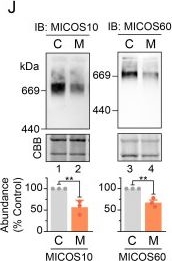 Fig.4.J showing Western Blotting in a Homo sapiens (Human) sample from the publication: Reduced Protein Import via TIM23 SORT Drives Disease Pathology in TIMM50-Associated Mitochondrial Disease.