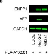 Fig.5.B showing Western Blotting in a Homo sapiens (Human) sample from the publication: Selection of a Clinical Lead TCR Targeting Alpha-Fetoprotein-Positive Liver Cancer Based on a Balance of Risk and Benefit.