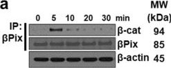 Fig.3.A showing Western Blotting from the publication: Muscarinic receptor agonist-induced βPix binding to β-catenin promotes colon neoplasia.