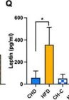Fig.2.Q showing Enzyme-linked immunosorbent assay from the publication: Effects of High-Fat Diet During Childhood on Precocious Puberty and Gut Microbiota in Mice.