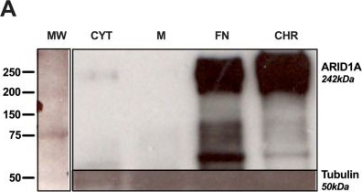 Fig.0.A showing Western Blotting in a Homo sapiens (Human) sample from the publication: Chromosome 1p and 6q Loss of Heterozygosity in Meningioma: A Comprehensive Analysis of the Two Chromatin Remodeling Complex Subunits ARID1A and ARID1B.