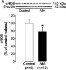 Fig.4.A showing Western Blotting in a Rattus norvegicus (Rat) sample from the publication: The Cerebral Brain-Derived Neurotrophic Factor Pathway, Either Neuronal or Endothelial, Is Impaired in Rats with Adjuvant-Induced Arthritis. Connection with Endothelial Dysfunction.