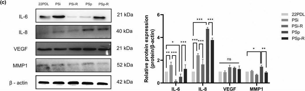 Fig.2.C showing Western Blotting from the publication: RNA m6A methylation regulatory mechanism of resveratrol in premature senescence cells.