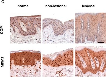 Fig.4.C showing Immunohistochemistry from the publication: Expression Patterns of Clock Gene mRNAs and Clock Proteins in Human Psoriatic Skin Samples.