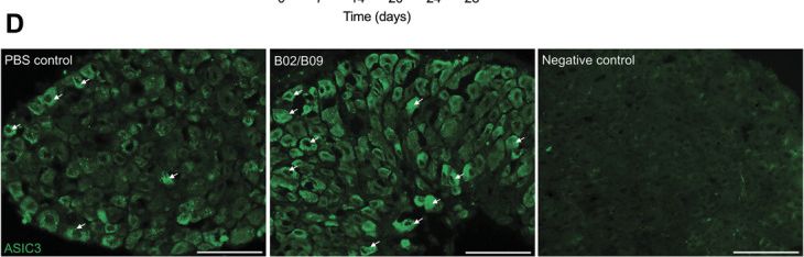 Fig.6.D showing Immunohistochemistry-immunofluorescence from the publication: Antibody-induced pain-like behavior and bone erosion: links to subclinical inflammation, osteoclast activity, and acid-sensing ion channel 3-dependent sensitization.