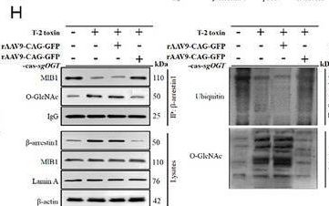 Fig.7.H showing Western Blotting in a Mus musculus (House mouse) sample from the publication: T-2 Toxin-Mediated β-Arrestin-1 O-GlcNAcylation Exacerbates Glomerular Podocyte Injury via Regulating Histone Acetylation.