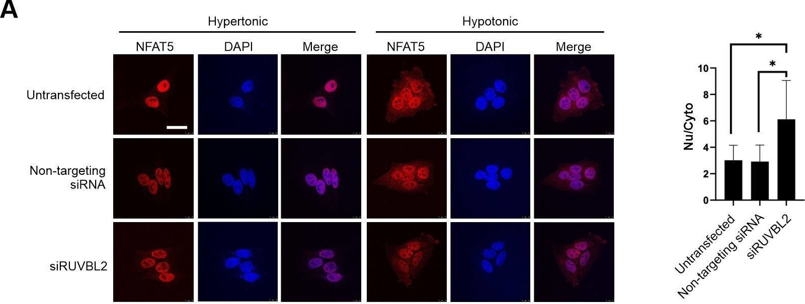 Fig.6.A showing Immunocytochemistry-immunofluorescence from the publication: Unconventional tonicity-regulated nuclear trafficking of NFAT5 mediated by KPNB1, XPOT and RUVBL2.