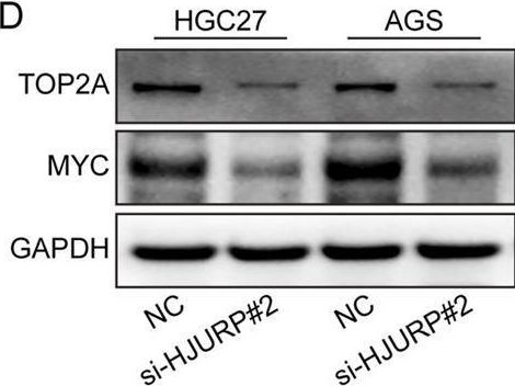 Fig.6.D showing Western Blotting in a Homo sapiens (Human) sample from the publication: HJURP modulates cell proliferation and chemoresistance via the MYC/TOP2A transcriptional axis in gastric cancer.