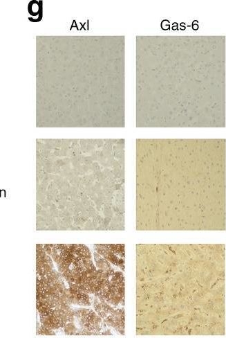 Fig.1.G showing Immunohistochemistry from the publication: Integrated analysis of multiple receptor tyrosine kinases identifies Axl as a therapeutic target and mediator of resistance to sorafenib in hepatocellular carcinoma.