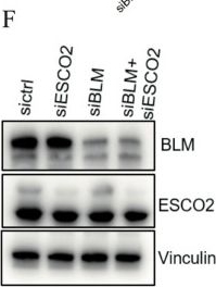 Fig.4.F showing Western Blotting in a Homo sapiens (Human) sample from the publication: ESCO2 Interacts with TRF1/2 and Facilitates Telomere Maintenance.