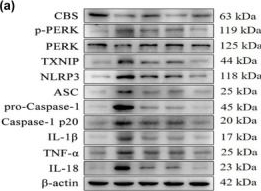Fig.8.A showing Western Blotting from the publication: Mechanism of paraventricular nucleus H2S on PERK/TXNIP/NLRP3 pathway in male spontaneously hypertensive rats.