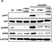 Fig.5.D showing Western Blotting from the publication: Ganglioside GM1 contributes to extracellular/intracellular regulation of insulin resistance, impairment of insulin signaling and down-stream eNOS activation, in human aortic endothelial cells after short- or long-term exposure to TNFα.