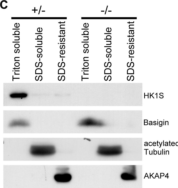 Fig.2.C showing Western Blotting in a Mus musculus (House mouse) sample from the publication: Spermatogenic cell-specific type 1 hexokinase (HK1S) is essential for capacitation-associated increase in tyrosine phosphorylation and male fertility in mice.