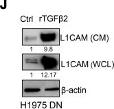Fig.7.J showing Western Blotting from the publication: Osimertinib activates a TGF-β2-dependent secretory program that drives lung adenocarcinoma progression.