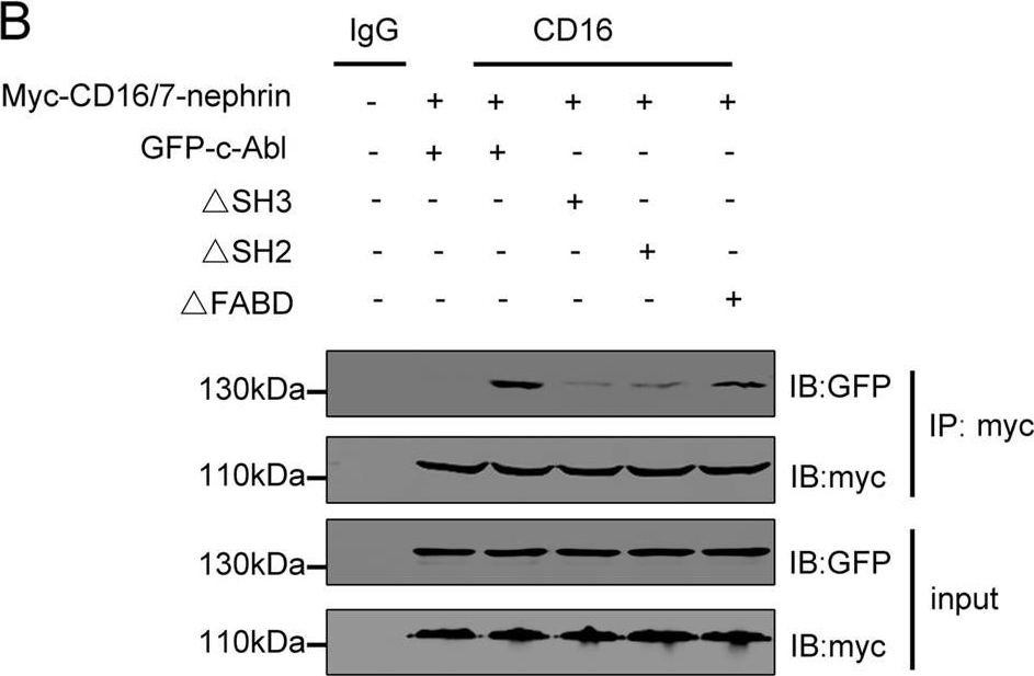 Role of c-Abl and nephrin in podocyte cytoskeletal remodeling induced by angiotensin II.