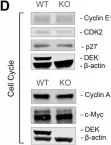 Fig.3.D showing Western Blotting from the publication: DEK regulates B-cell proliferative capacity and is associated with aggressive disease in low-grade B-cell lymphomas.