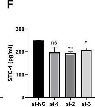 Fig.7.F showing Enzyme-linked immunosorbent assay from the publication: MSCs promote the efferocytosis of large peritoneal macrophages to eliminate ferroptotic monocytes/macrophages in the injured endometria.