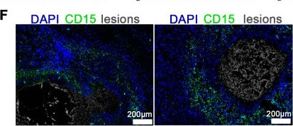 Fig.8.F showing Immunohistochemistry-immunofluorescence from the publication: Imaging mass cytometry of the immune microenvironment in alveolar echinococcosis.