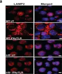 Fig.4.A showing Immunocytochemistry-immunofluorescence from the publication: IRF8 directs stress-induced autophagy in macrophages and promotes clearance of Listeria monocytogenes.