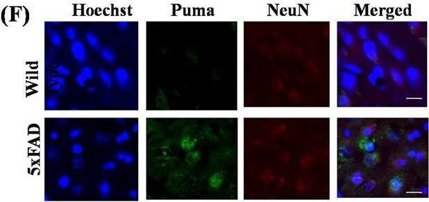 Fig.6.F showing Immunocytochemistry-immunofluorescence in a Mus musculus (House mouse) sample from the publication: BH3-only proteins Puma and Beclin1 regulate autophagic death in neurons in response to Amyloid-β.