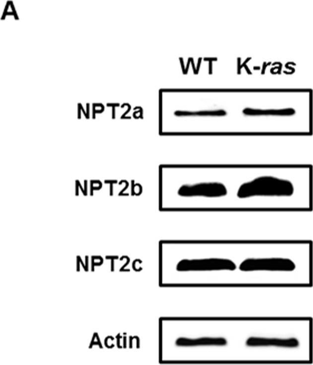 Fig.1.A showing Western Blotting from the publication: Knockdown of the sodium-dependent phosphate co-transporter 2b (NPT2b) suppresses lung tumorigenesis.