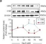 Fig.1.D showing Western Blotting in a Mus musculus (House mouse) sample from the publication: H2S and homocysteine control a novel feedback regulation of cystathionine beta synthase and cystathionine gamma lyase in cardiomyocytes.