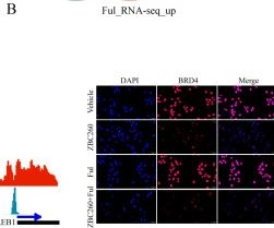 Fig.6.B showing Immunocytochemistry-immunofluorescence in a Homo sapiens (Human) sample from the publication: BRD4 PROTAC degrader enhances fulvestrant sensitivity in ER+ breast cancer via super-enhancer associated GREB1.